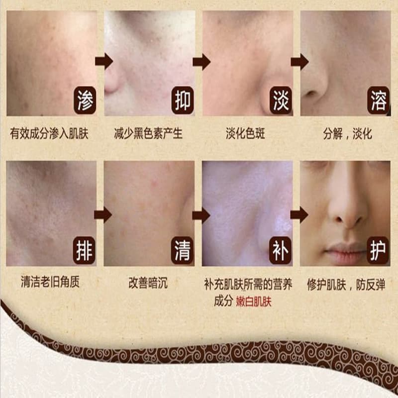 Mặt Nạ ngọc thảo dược Nữ dưỡng ẩm chăm sóc da trị mụn đầu đen, làm sáng da, làm mờ vết nám, mỹ phẩm mặt nạ Bletilla striata-duoc-ban-tai-Nhập Hàng Giá Tốt