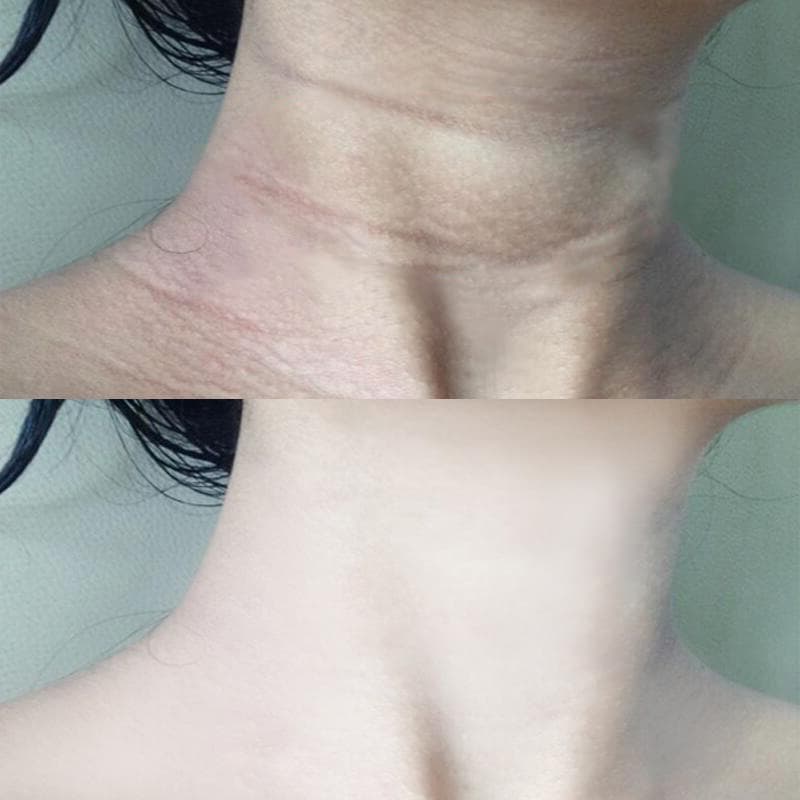 100g Xuan Qing làm sáng màu da Kem dưỡng da vùng cổ nicotinamide nâng cơ làm săn chắc và làm mờ nếp nhăn vùng cổ Mặt nạ vùng cổ Chăm sóc vùng cổ-duoc-ban-tai-Nhập Hàng Giá Tốt