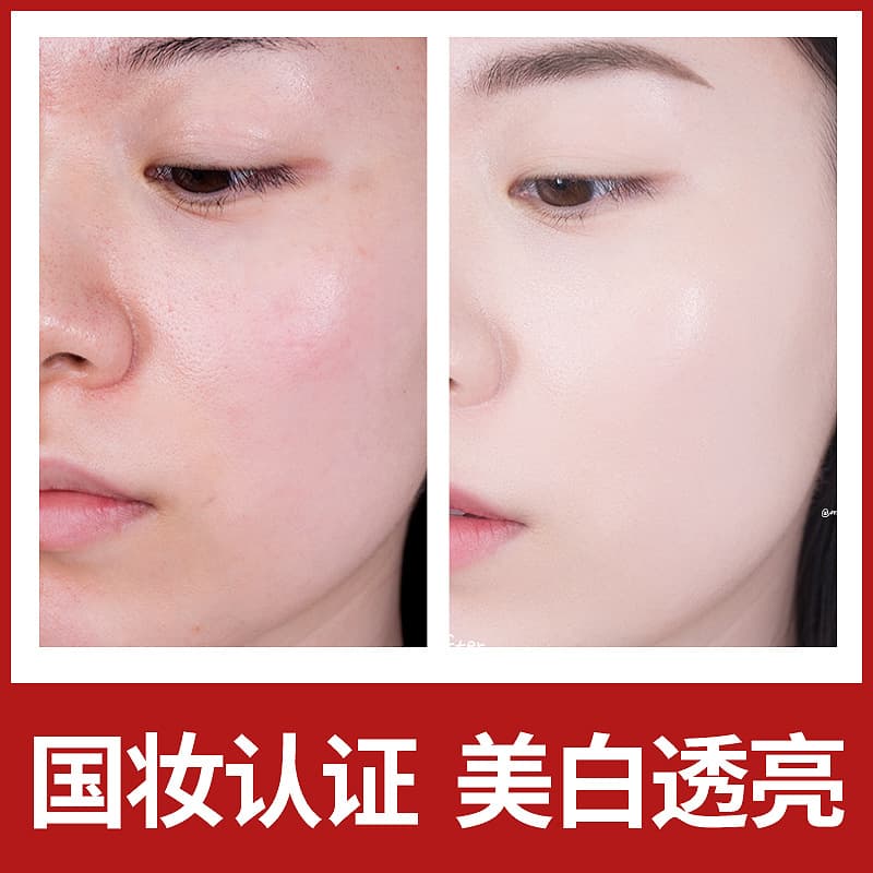 Weishangmei làm trắng và trị tàn nhang Kem làm trắng da Feisi Shop 50 g/chai-duoc-ban-tai-Nhập Hàng Giá Tốt