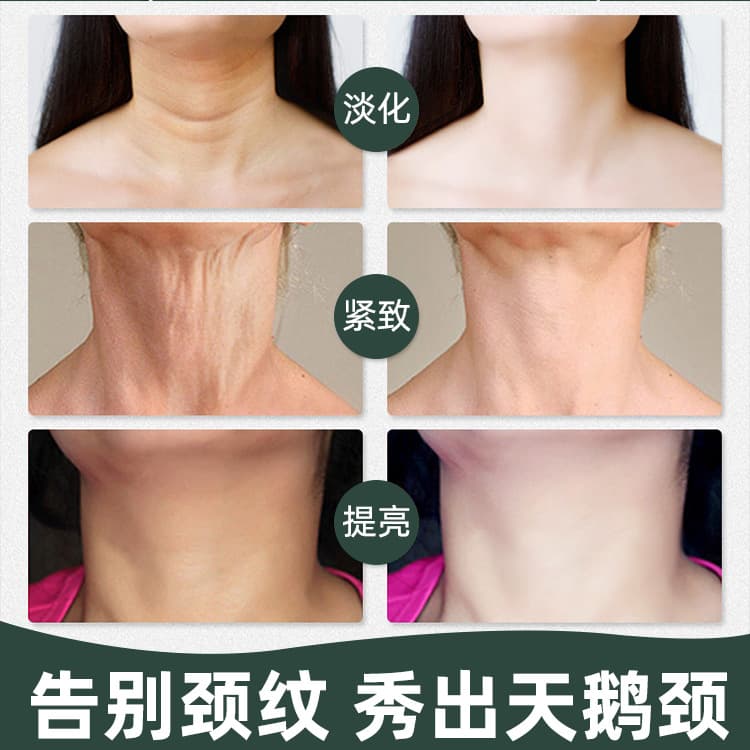 100g Xuan Qing làm sáng màu da Kem dưỡng da vùng cổ nicotinamide nâng cơ làm săn chắc và làm mờ nếp nhăn vùng cổ Mặt nạ vùng cổ Chăm sóc vùng cổ-duoc-ban-tai-Nhập Hàng Giá Tốt